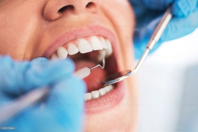 5 Tips to Keep Your Teeth Healthy