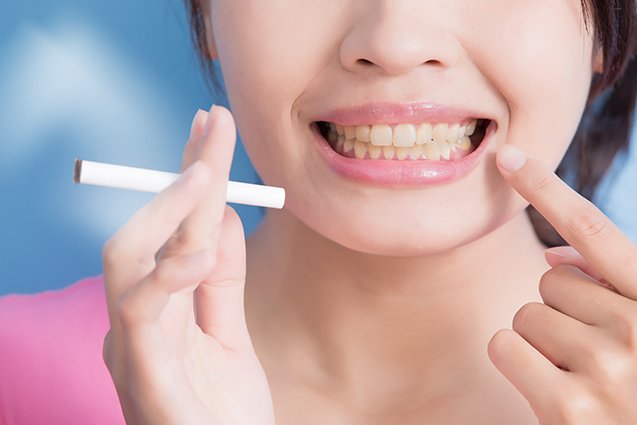 Toll of Tobacco: The Impact of Smoking on Oral Health